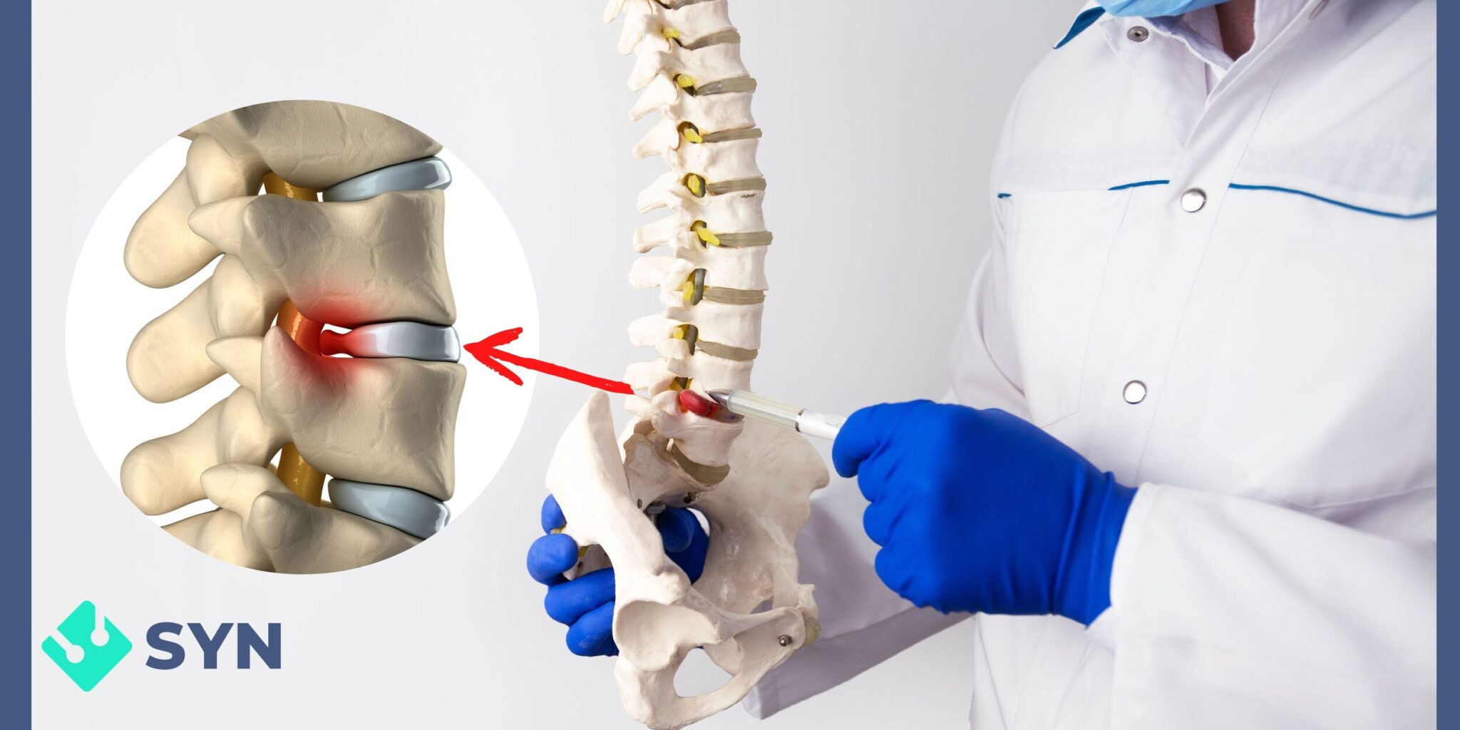 Quanto Custa Uma Cirurgia De Hérnia