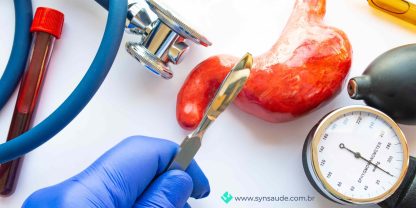 BlogdeSaude_SYN_cirugiaparticular_semplanodesaude (16)