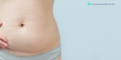 BlogdeSaude_SYN_cirugiaparticular_semplanodesaude - 2023-06-21T155214.403