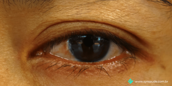 BlogdeSaude_SYN_cirugiaparticular_semplanodesaude - 2023-06-21T181533.073