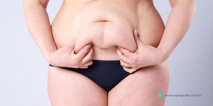 BlogdeSaude_SYN_cirugiaparticular_semplanodesaude - 2023-07-12T152645.179